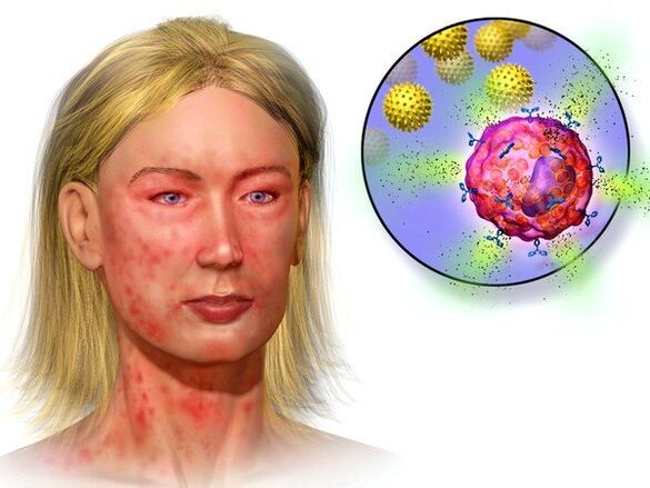 ehinokoke i simptome njihove prisutnosti u tijelu